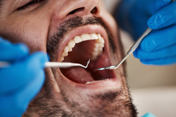 Best Full Mouth Reconstruction  in Gluckstadt, MS